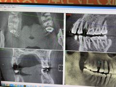 -土豆口腔(凤凰北总店)