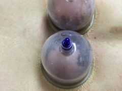 -沈师傅盲人按摩工作室(密三小区店)