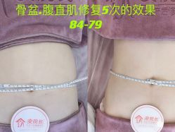 点击看大图 -安院长·产后恢复·徒手骨盆(先天下店)