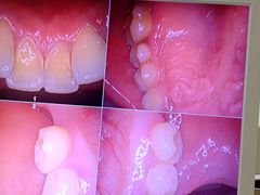 -土豆口腔(凤凰北总店)