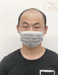 -发饰美男士增发补发假发定制店