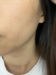 -广州美莱医疗美容医院