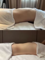-Fundi张玉珊修身堂·indiba·BTL科技瘦身