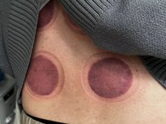 -牛市口盲人按摩(舒康分院)