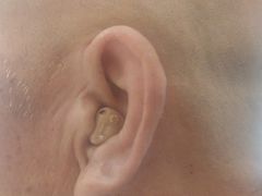 -安湃声助听器(密云店)