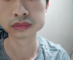 -厦门美莱整形美容医院