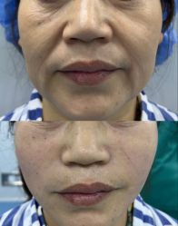 点击看大图 -郡艺医疗美容·微整·眼鼻吸脂