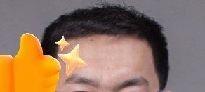 -大麦微针植发丨全国连锁