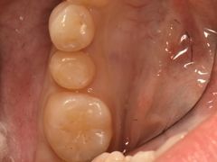 -精德口腔·种植修复·儿牙中心(财富中心店)