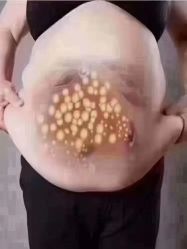 -香薇妮丝女子减肥院