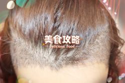 -大麦微针植发全国连锁