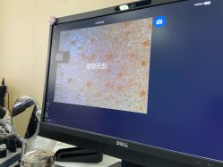 -悟空祛痘·诺奖技术专业店