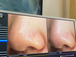 -苑苑vbeauty科技美容SPA