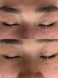 -AGE LOCK 锁龄美肌