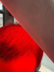 -碧莲盛·不剃发植发