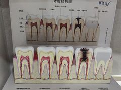 -上海仁爱医院口腔科 · 种植