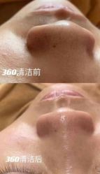 点击看大图 -智丽佳人祛斑祛痘美容美体