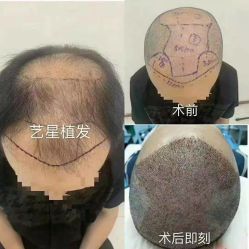 -Yestar艺星医疗美容医院