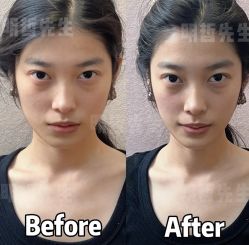 -颜和骨正&明星徒手小颜整骨