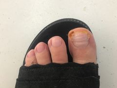 -新甲连锁灰指甲·甲沟炎·鸡眼(黑龙江路店)