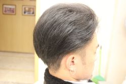 点击看大图 -大麦微针植发丨全国连锁