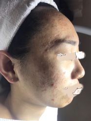 -皇族养心堂·净痘·修敏·御颜