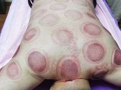 -沈师傅盲人按摩工作室(密三小区店)