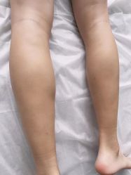 -楚沅先生专业男士脱毛连锁