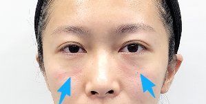 -天津健丽·去眼袋医疗美容机构