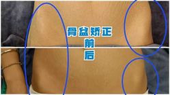 -蓝丝带产后恢复中心(都江堰店)