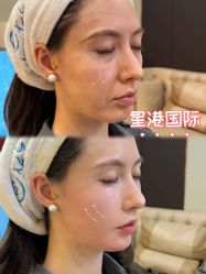 -星港国际·Skin皮肤专研·皮肤管理