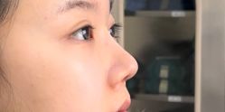体验后-天津伊美尔医疗整形美容专科医院