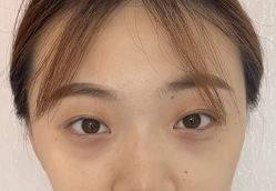 点击看大图 -天津健丽·去眼袋医疗美容机构