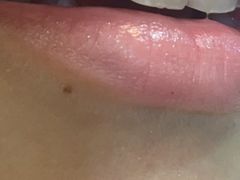 -常熟玉蕙口腔医院