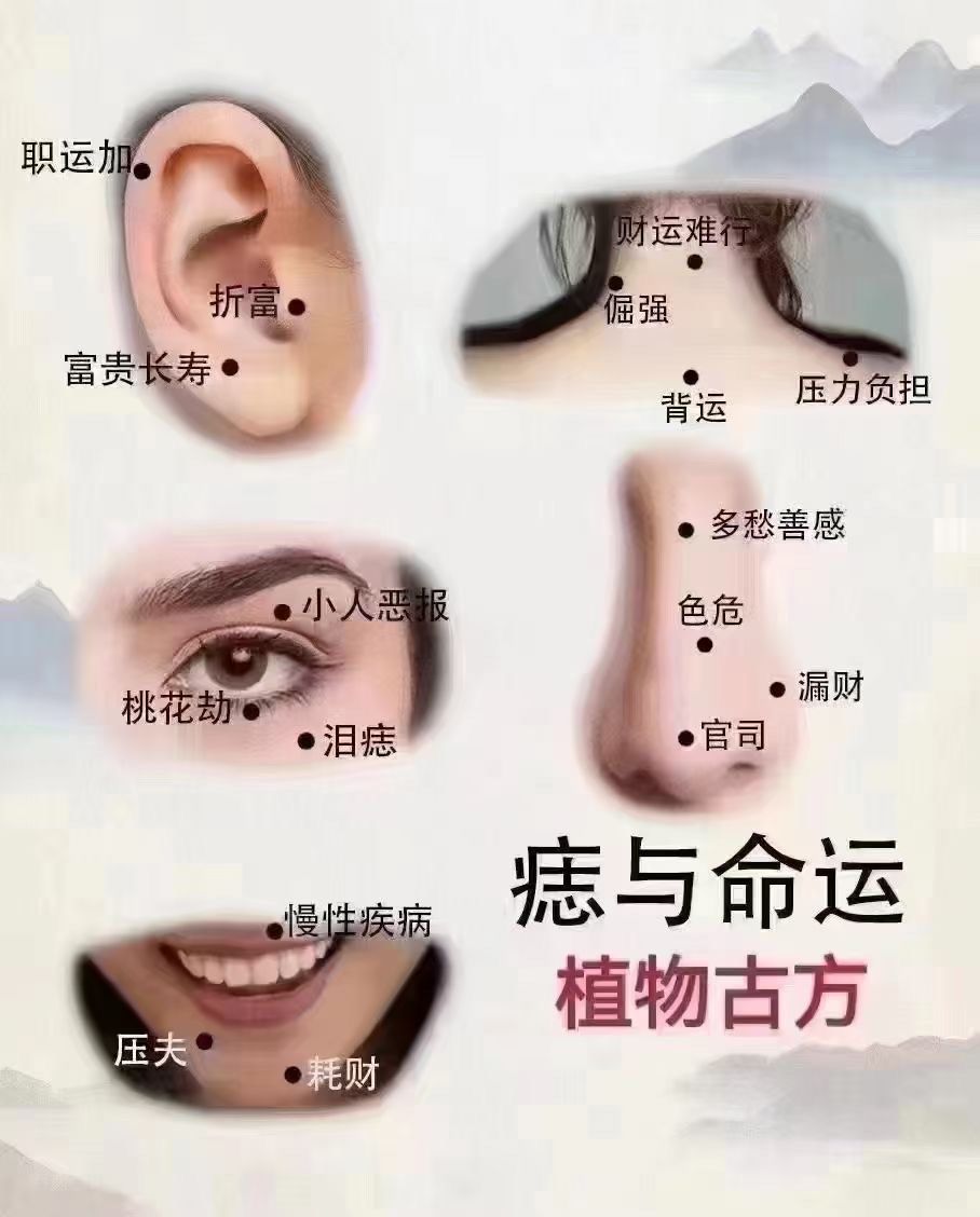 人为什么会长痦子