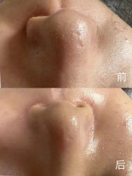 -宥莉·ULLY 痘敏肌•科技皮肤管理中心