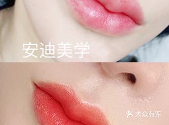 纹唇不再红肿结痂香肠嘴了，做完就很自然