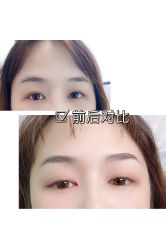 -MIVI半永久纹眉纹绣