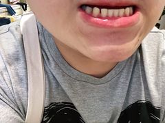-柏乐口腔医院·舒适化无痛种植牙中心(东盟商务区院)