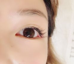 -宥莉·ULLY 痘敏肌•科技皮肤管理中心