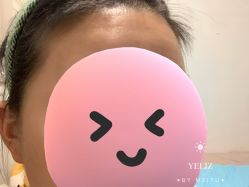 点击看大图 体验后-奈弗里·疗愈SPA·美肤中心