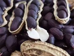 -浙江大学医学院附属第一医院(庆春院区)