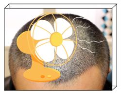 -大麦微针植发全国连锁