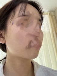 体验前-上海首尔丽格医疗美容医院