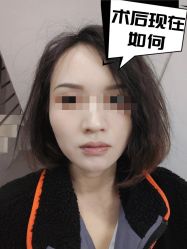 -素美医疗美容·西南眼鼻整形·修复基地