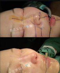 -北京米扬丽格医疗美容·联合丽格鼻整形中心