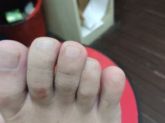 -世龙世家灰指甲·甲沟炎·跖疣护理·修脚(东江湾路店)