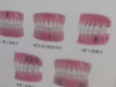 -圣呗口腔·舒适化种植牙·矫正中心(广州总院)