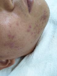 -痘博士北京·全国连锁祛痘机构