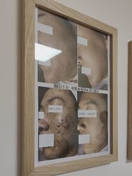 -美肤盾祛痘·问题肌头疗管理中心